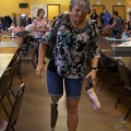 A giant step forward for artificial limbs