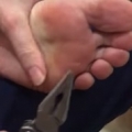 Thumb for World's Biggest Splinter 